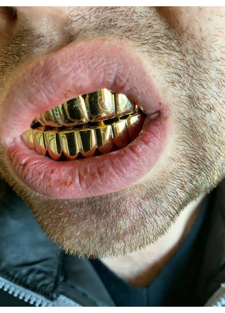 Classic Grillz